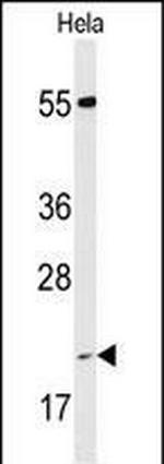 Cyclophilin C Antibody in Western Blot (WB)