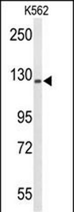 TREF1 Antibody in Western Blot (WB)