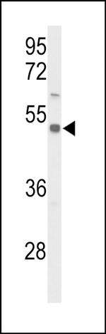 SLC39A8 Antibody in Western Blot (WB)