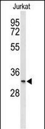 TMEM150A Antibody in Western Blot (WB)