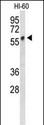 PLVAP Antibody in Western Blot (WB)