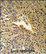 COG2 Antibody in Immunohistochemistry (Paraffin) (IHC (P))