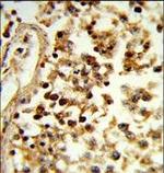 IL-31 Antibody in Immunohistochemistry (Paraffin) (IHC (P))