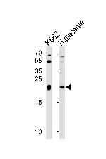 IL-31 Antibody in Western Blot (WB)