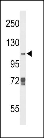 JMJD2B Antibody in Western Blot (WB)