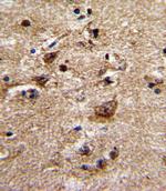 alpha-1b Adrenergic Receptor Antibody in Immunohistochemistry (Paraffin) (IHC (P))