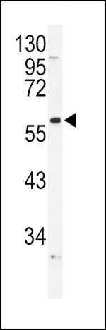 alpha-1b Adrenergic Receptor Antibody in Western Blot (WB)