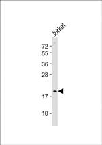 p19 INK4d Antibody in Western Blot (WB)