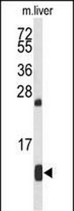 HBA2 Antibody in Western Blot (WB)