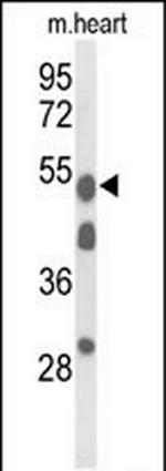 A1BG Antibody in Western Blot (WB)