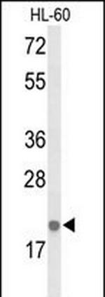 IL-26 Antibody in Western Blot (WB)