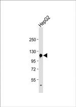 GLDC Antibody in Western Blot (WB)