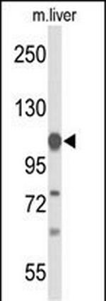 GLDC Antibody in Western Blot (WB)