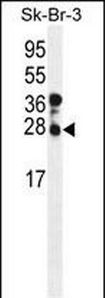 CHMP4B Antibody in Western Blot (WB)