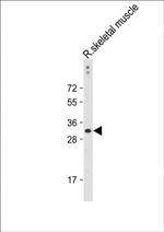 DIO3 Antibody in Western Blot (WB)