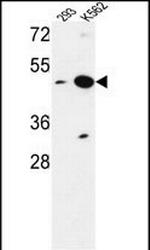 NUPL2 Antibody in Western Blot (WB)