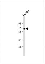 SGSH Antibody in Western Blot (WB)