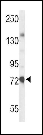 ChAT Antibody in Western Blot (WB)