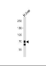 OATP2 Antibody in Western Blot (WB)