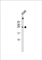 AANAT Antibody in Western Blot (WB)