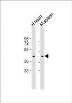 MTCO1 Antibody in Western Blot (WB)