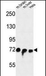 FAM40A Antibody in Western Blot (WB)