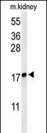 LYPD1 Antibody in Western Blot (WB)