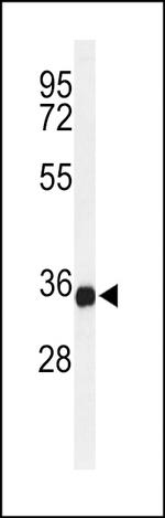 STING Antibody in Western Blot (WB)