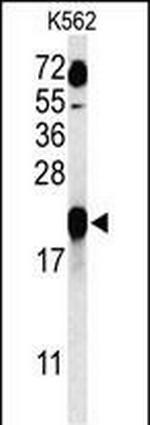 GAGE7 Antibody in Western Blot (WB)