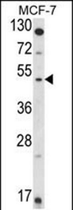 HSD11B2 Antibody in Western Blot (WB)