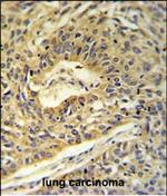 ATP5A1 Antibody in Immunohistochemistry (Paraffin) (IHC (P))