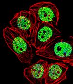 FOXG1 Antibody in Immunocytochemistry (ICC/IF)