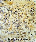 LMBR1L Antibody in Immunohistochemistry (Paraffin) (IHC (P))