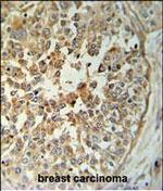 STING Antibody in Immunohistochemistry (Paraffin) (IHC (P))