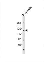 ADAM19 Antibody in Western Blot (WB)