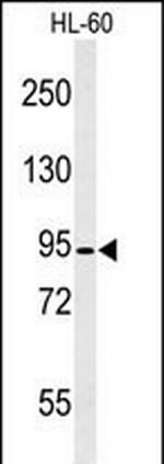 Calpain 3 Antibody in Western Blot (WB)