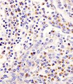 PLA2G7 Antibody in Immunohistochemistry (Paraffin) (IHC (P))