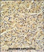 HOXA3 Antibody in Immunohistochemistry (Paraffin) (IHC (P))