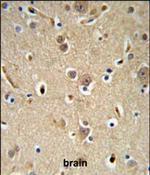 NEDD4 Antibody in Immunohistochemistry (Paraffin) (IHC (P))