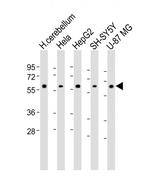 AMH Antibody in Western Blot (WB)