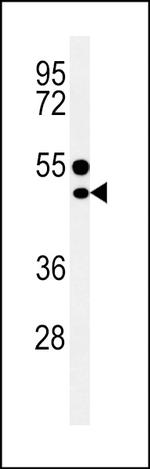 CD1e Antibody in Western Blot (WB)