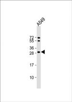 SPR Antibody in Western Blot (WB)