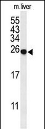 SPR Antibody in Western Blot (WB)