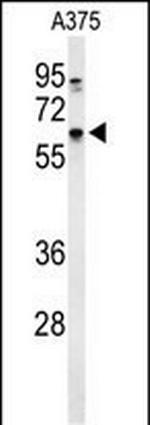 DCT Antibody in Western Blot (WB)