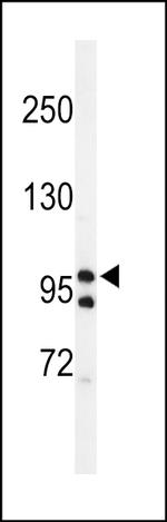 TAF2 Antibody in Western Blot (WB)