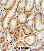 GALNT5 Antibody in Immunohistochemistry (Paraffin) (IHC (P))