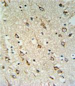 DNAJC6 Antibody in Immunohistochemistry (Paraffin) (IHC (P))