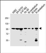 DNAJC6 Antibody in Western Blot (WB)