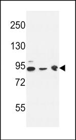 DNAJC6 Antibody in Western Blot (WB)