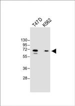 YTHDF3 Antibody in Western Blot (WB)